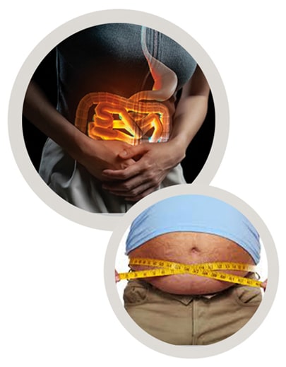 درمان چاقی در مردان - چاقی شکم در زنان - لاغر شدن